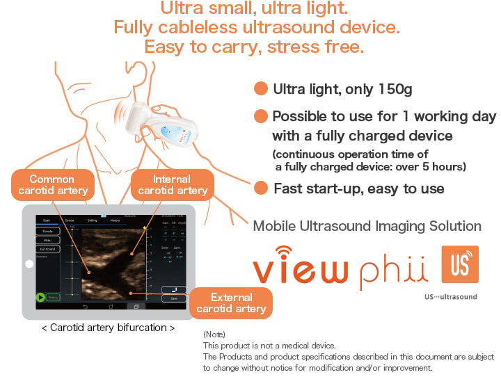 Ultra small, ultra light. Fully cableless ultrasound device.Easy to carry, stress free. 